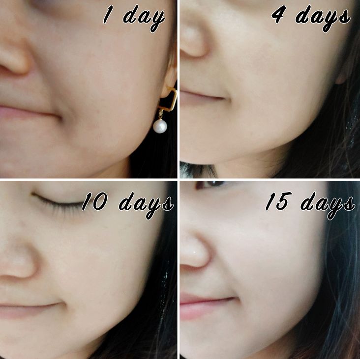 熬夜最好的回血方法,熬夜回血的最好方法