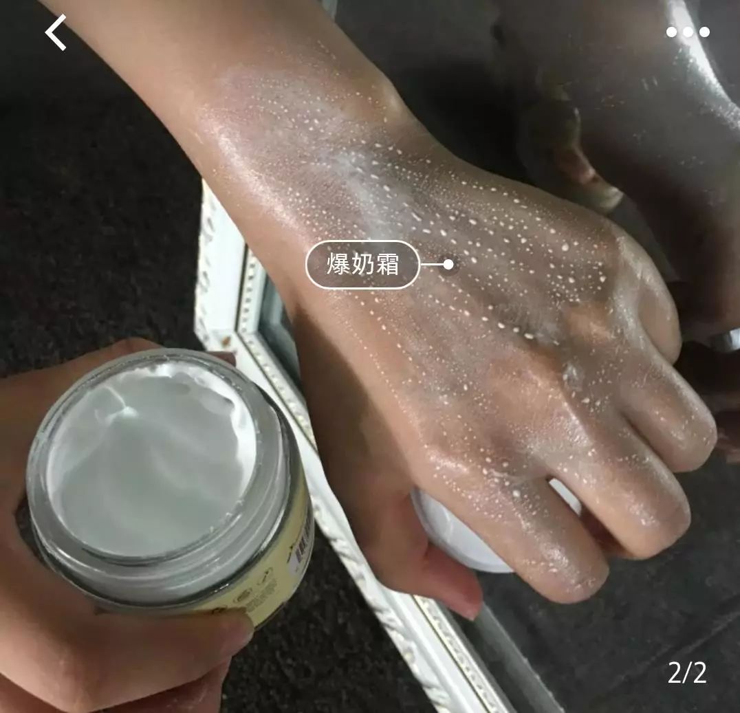 脱发算啥！90后已经开始长“老年斑”了，有人还为此花了10多万！