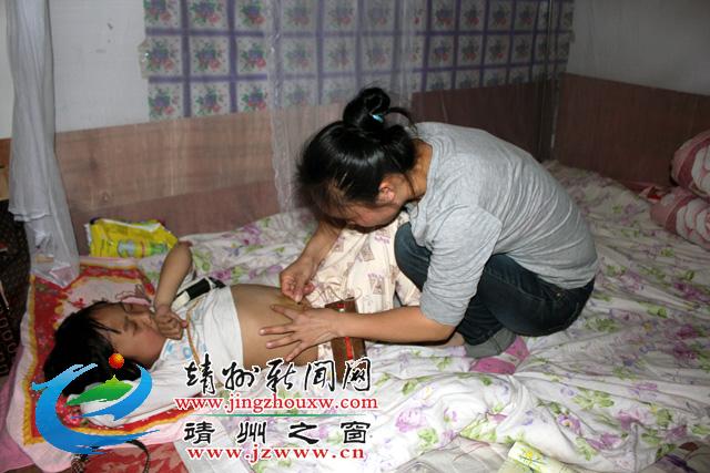 地贫女孩移植,地贫移植术后排异