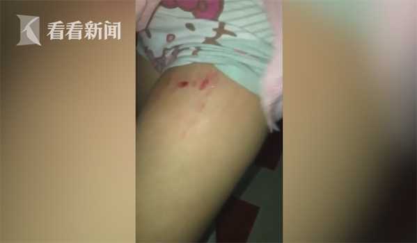 女子商场滑倒小朋友,6岁女童在商场被故意绊倒后续