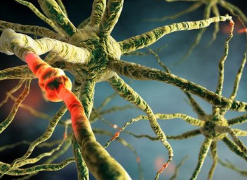 2型糖尿病周围神经病变能治好吗,糖尿病神经病变面瘫能治好吗