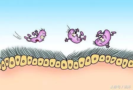 导致支气管扩张症最常见的病因,支气管扩张自幼发病