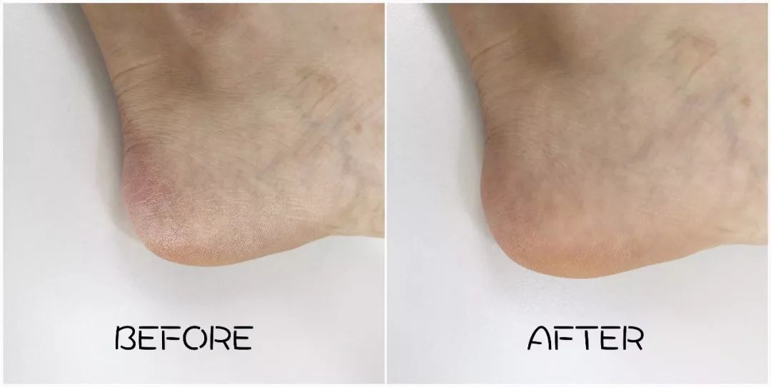 团购开抢｜嫩出水、白成雪、滑溜溜的肌肤，靠这款身体乳就够了