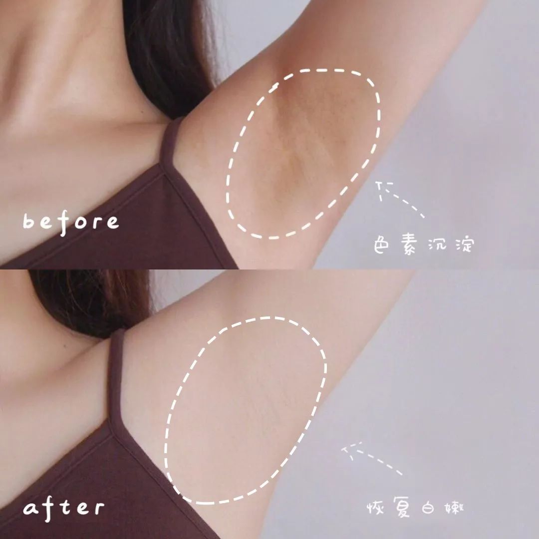 精致从头到脚,细节展现气质,一块嫩红皂让你6周变粉嫩少女!