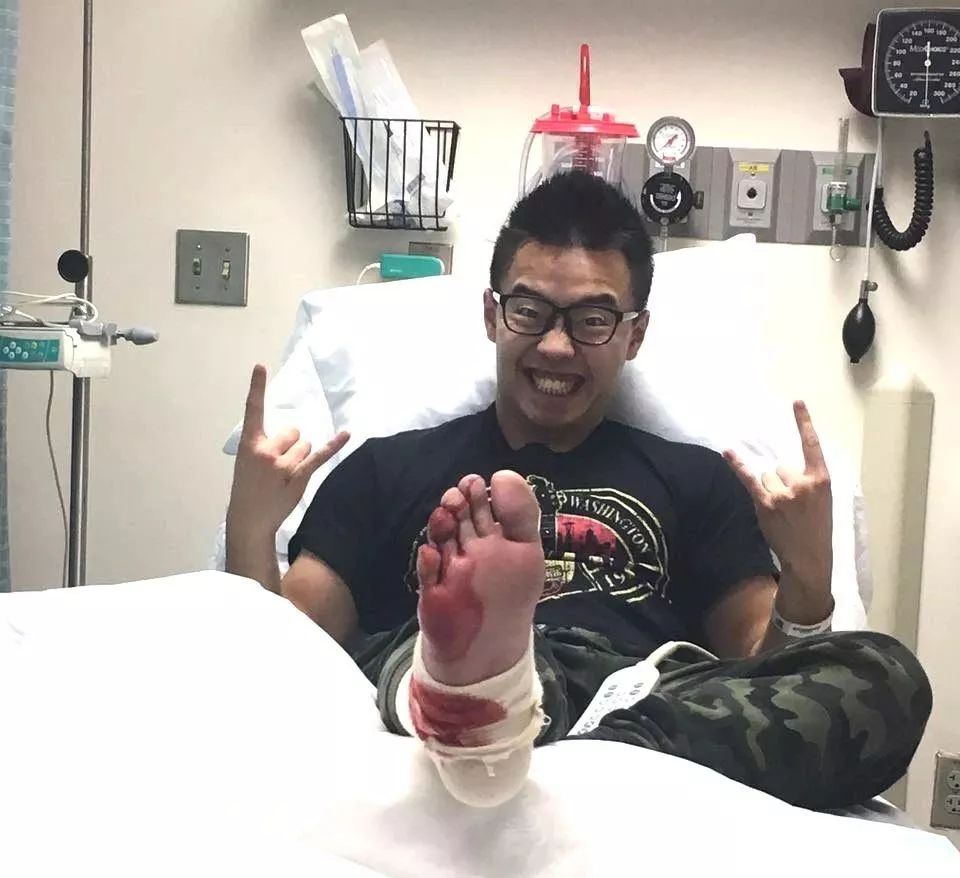 俄罗斯留学生骨折截肢,留学生意外被截肢