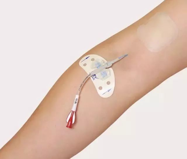 picc置管后我该如何维护,picc置管术后期维护要多少钱