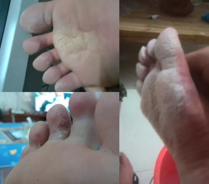 这颗小白球，居然彻底治愈了我的脚臭，日本家庭必备的除臭杀菌神物，三分钟还你一个清新的“脚气”！