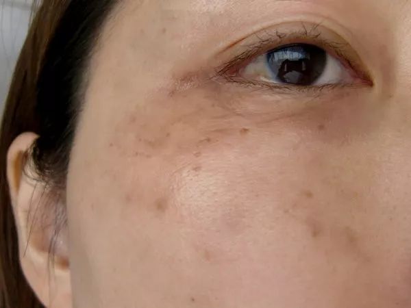 老公嫌老婆丑我们有小三怎么办,老公嫌我丑找小三