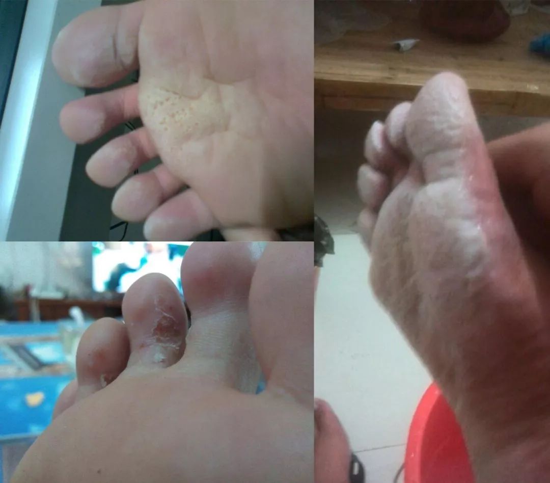 这颗小白球,居然彻底治愈了我的脚臭,日本家庭必备的除臭杀菌神物,三分钟还你一个清新的“脚气”!