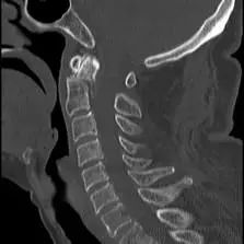 鍕囬棷鐢熷懡绂佸尯鍖婚櫌,鍕囬棷鐢熷懡绂佸尯浜旀鍙仠鎵嬫湳