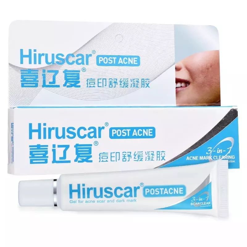 长痘总是反反复复怎么办,经常长痘的原因和解决方法