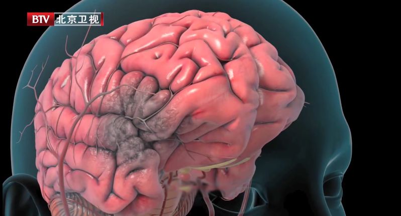 高血压一年之内发现算晚吗,高血压患者如何判断血压是否正常