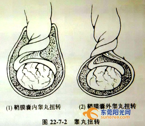 12岁小孩关节酸痛是什么原因,青少年出现身体各处疼痛