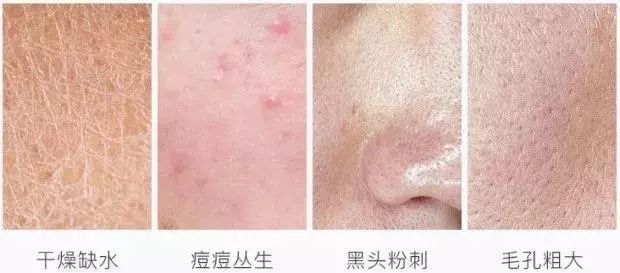 日本保湿清洁洗面奶,日本火山灰樱花洗面奶