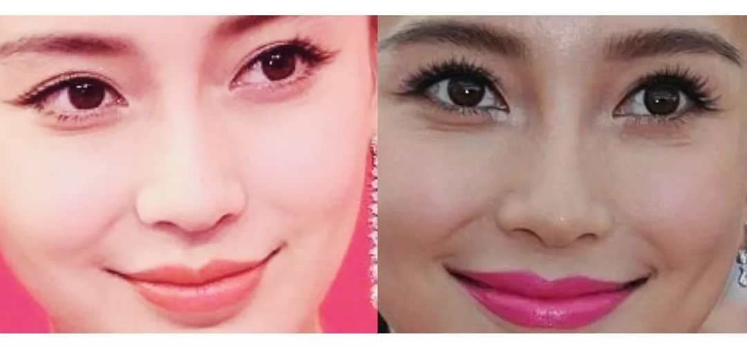 法令纹用一支玻尿酸够了没有,玻尿酸冻干眼纹贴