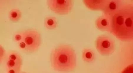 常见的眼疾病有哪些,秋冬眼病高发这几种眼病不得不防