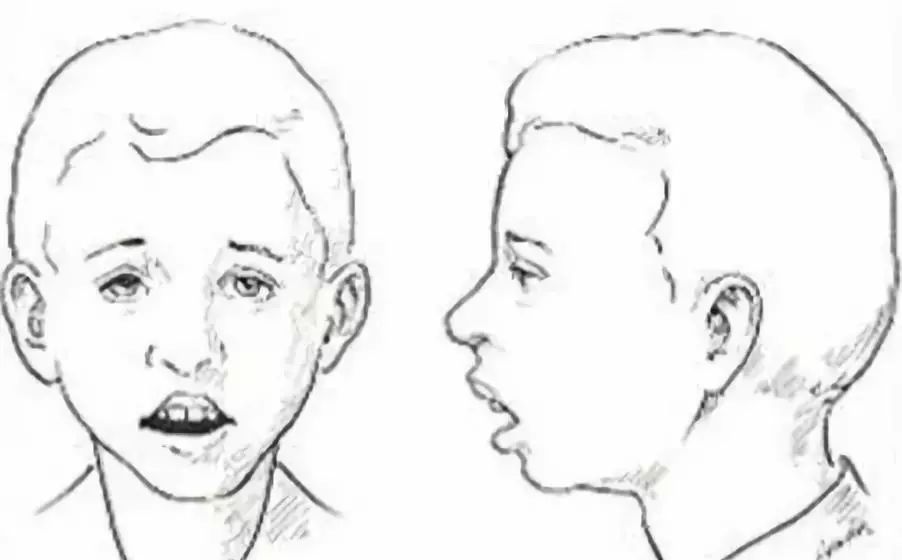 拉低整体颜值,拉低了颜值