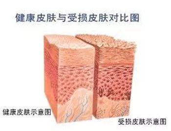 痘印红血丝修复护肤品平价,痘印泛红团购