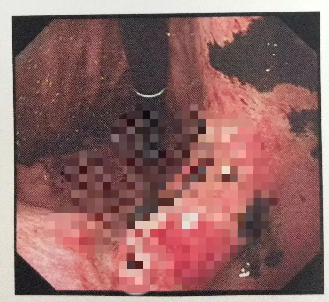 男友联系前任女子吃5包辣条,男友和女友吃辣条