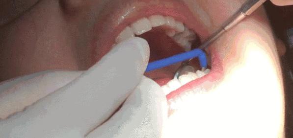 不到1折疯抢！全家口腔健康有保证~29.9元抢购原价895元劲松牙科家庭口腔护理套餐！超声波洁牙+中老年口腔护理+儿童口腔护理…