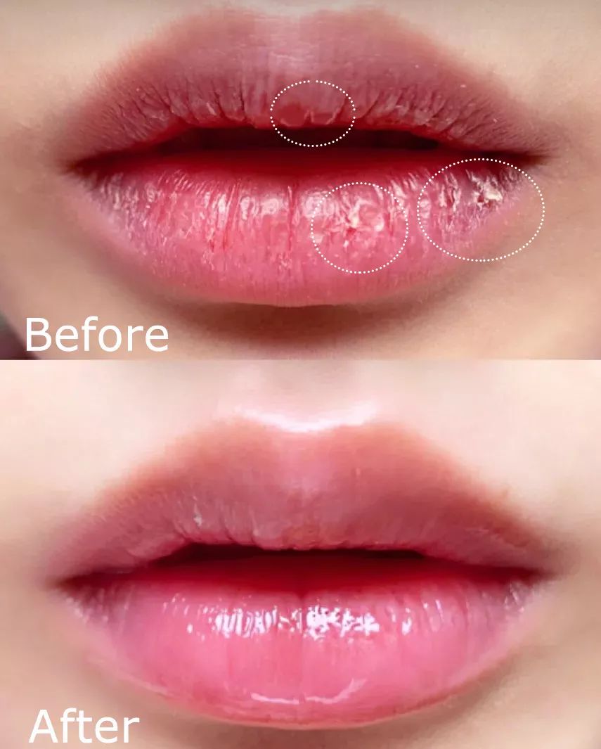 软化死皮淡化唇纹唇膜,唇霜去死皮淡化唇色