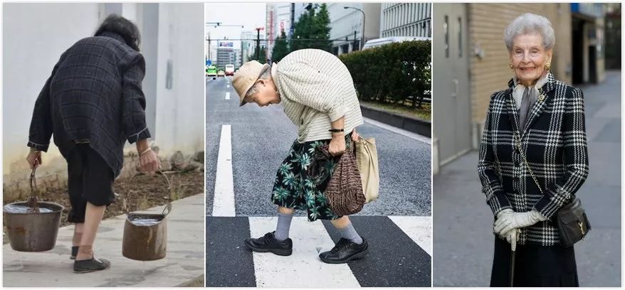 人过了50岁以后为什么会缺钙,人老后身体会出现哪些问题