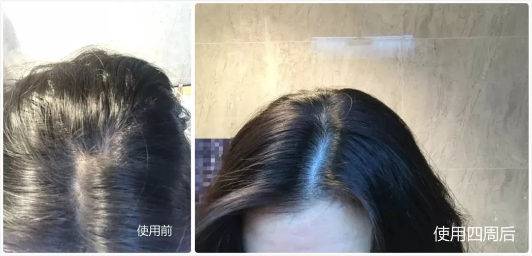 新西兰深度睡眠喷雾,新西兰深睡眠喷雾