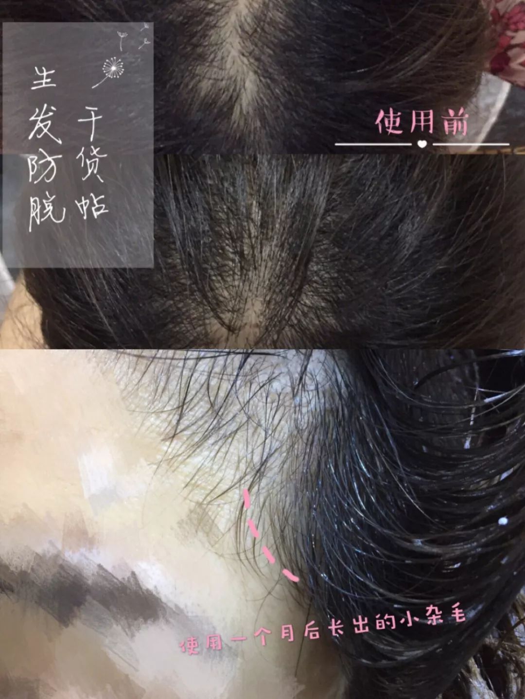 新西兰深度睡眠喷雾,新西兰深睡眠喷雾