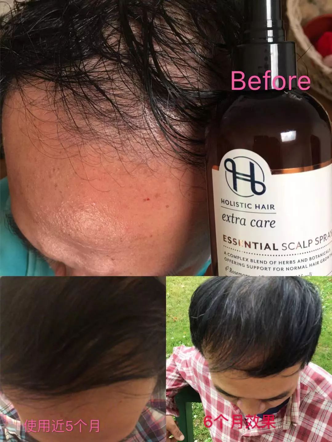 新西兰高端沙龙专用，2秒1喷，增发从“根”开始