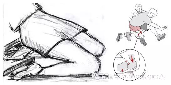 膝内侧副韧带损伤吃什么药,膝韧带损伤预防与康复训练