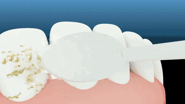 团购|俄罗斯亮白牙膏组合，轻松瓦解多年牙垢，清新口气告别黄牙