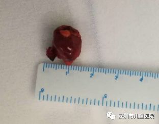 六岁的她每天都用“姨妈巾”,罪魁祸首是……家长注意,这怪病“偏爱”女孩