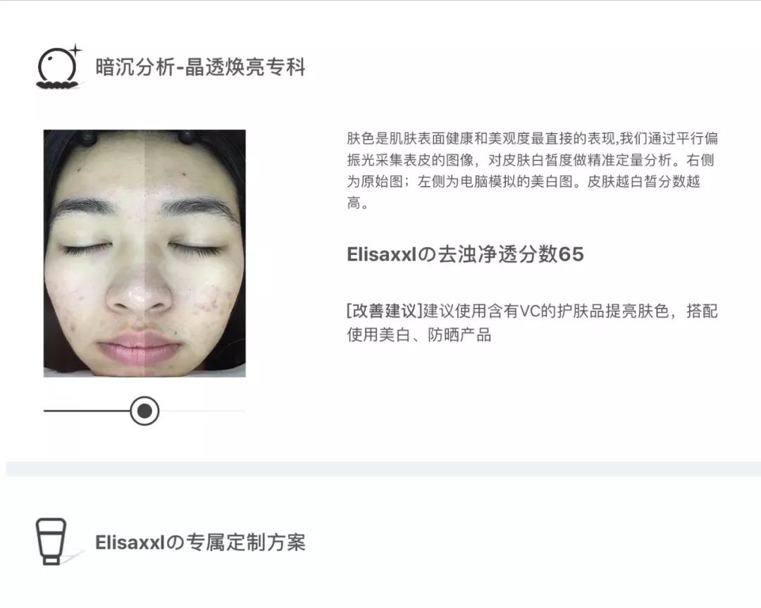 灏忚寕鑲岃瘖瀹ゅ埌搴曟湁澶氬己,灏忚寕鑲岃瘖瀹よˉ姘村悧