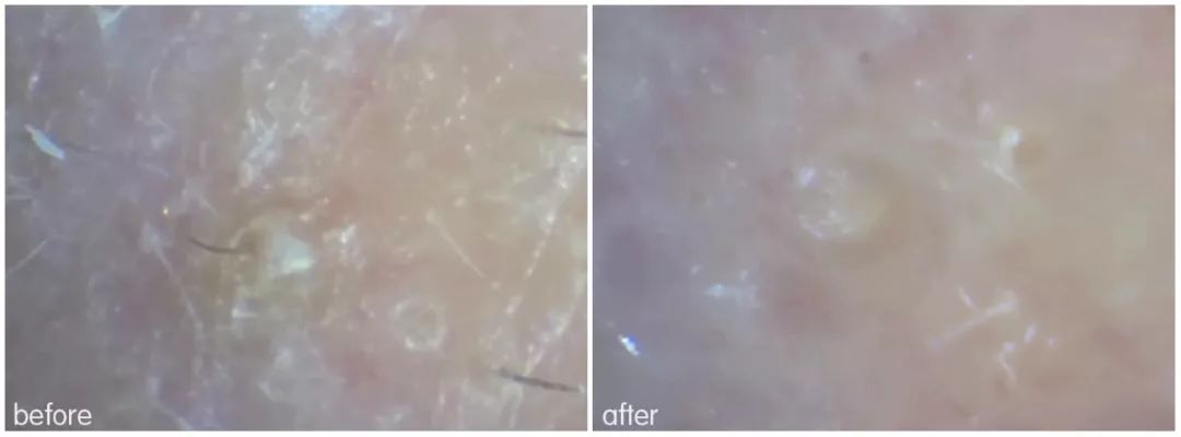 灏忚寕鑲岃瘖瀹ゅ埌搴曟湁澶氬己,灏忚寕鑲岃瘖瀹よˉ姘村悧