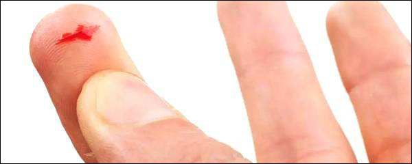 手指头被割伤很深一个口子,手指被纸划伤为什么那么痛