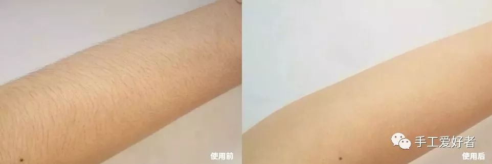 平价又好用的脱毛神器学生党温和,英国脱毛最好的产品适合学生党