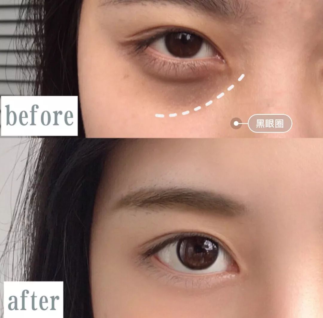 25岁必须用眼霜了吗,25岁之后适合用什么眼霜