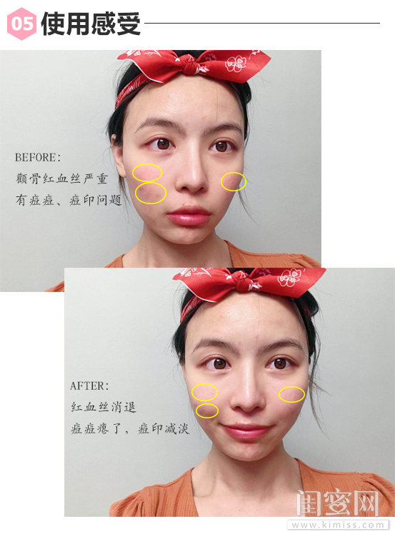 可复美胶原蛋白面膜测评,敏感肌救星抗敏修复