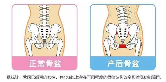 刘诗诗生完娃谁照顾,刘诗诗生子后的保养