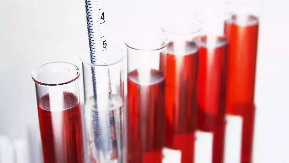 有一种尿的颜色或是癌症信号，赶紧检查一下你尿液的颜色！