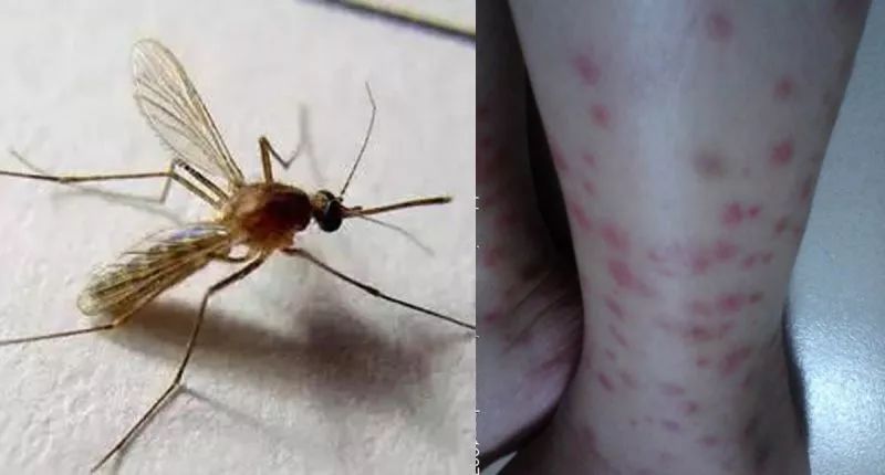 泰国青草膏驱蚊止痒防蚊虫叮咬,泰国蚊子叮咬止痒膏