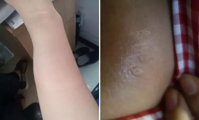 广东下雨后出现的虫子,广东雨后常见的虫子