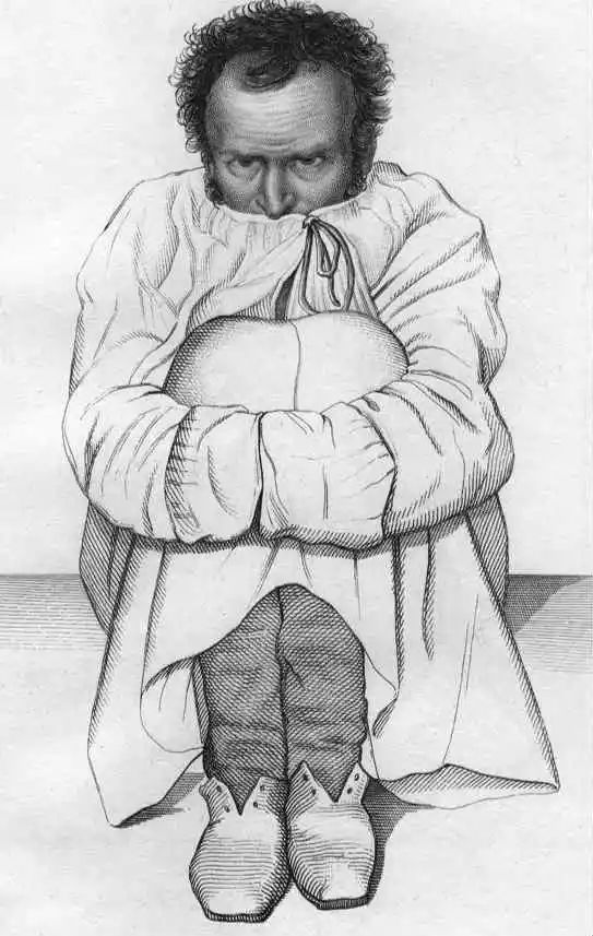 漂泊狂：在过去，到处旅游是一种精神疾病