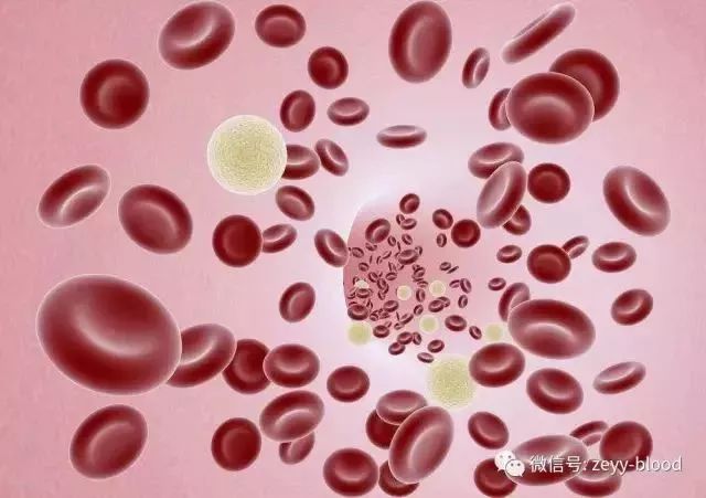 免疫性血小板减少症基因检测,重型免疫性血小板减少症标准