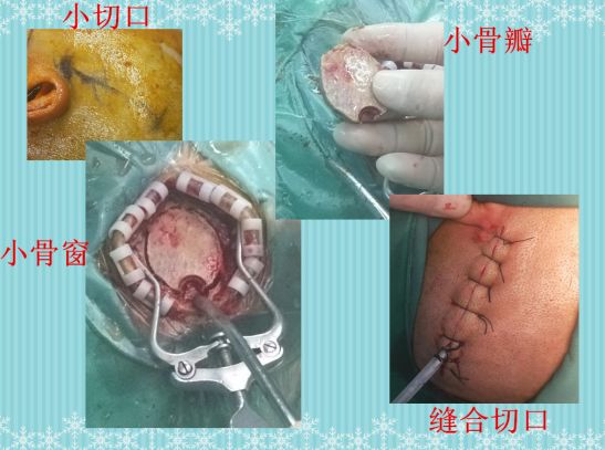 打开一扇“小窗”，还您身体健康！