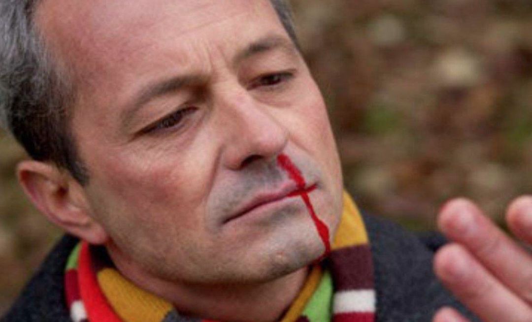 已经上火如何快速祛火,清火治上火最好的方法