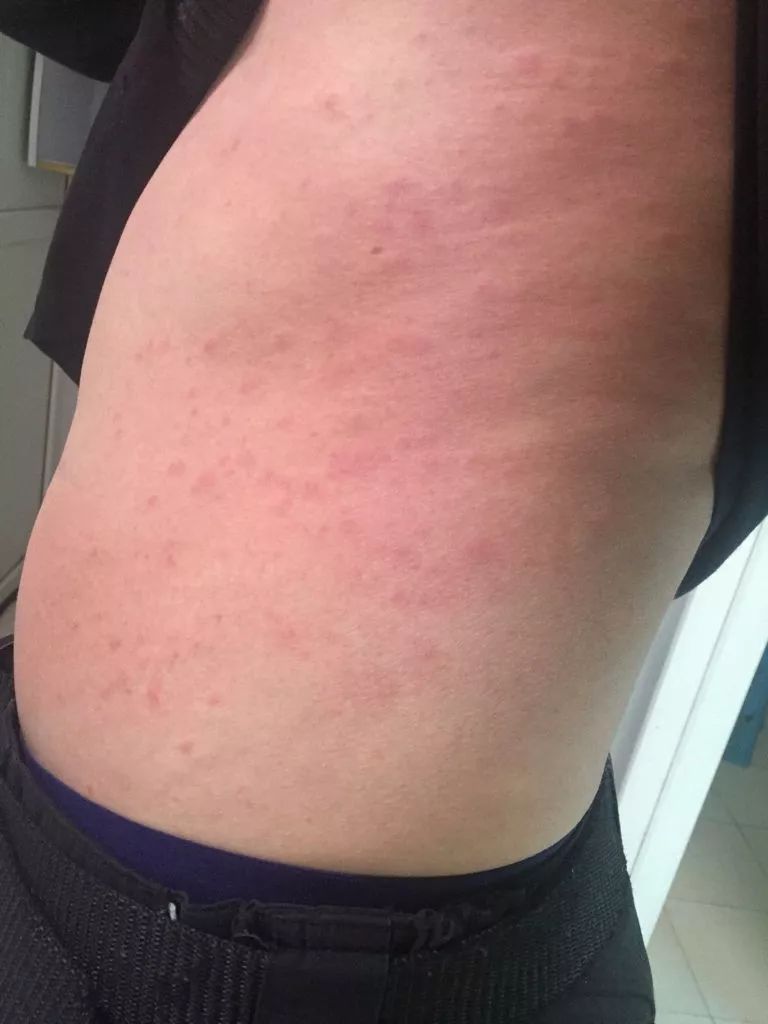 惊天黑幕！HM，ZARA等快时尚品牌的牛仔裤，已导致多*皮人**肤腐烂，恶臭，不孕...