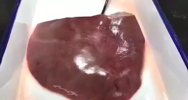 新型神奇胶水,新型生物胶水止血