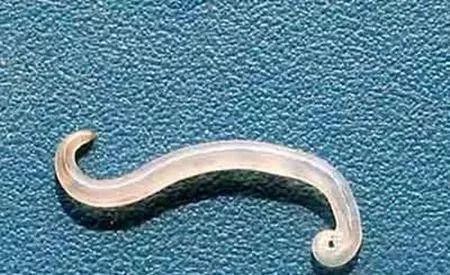 20岁女生脑袋里惊现27厘米长活虫,头上有白色长条小虫是什么