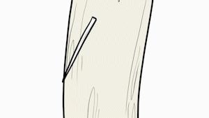 凶险！一口气喝完鱼汤后胸口刺痛！没想到竟需要8个科室10多位专家联手……